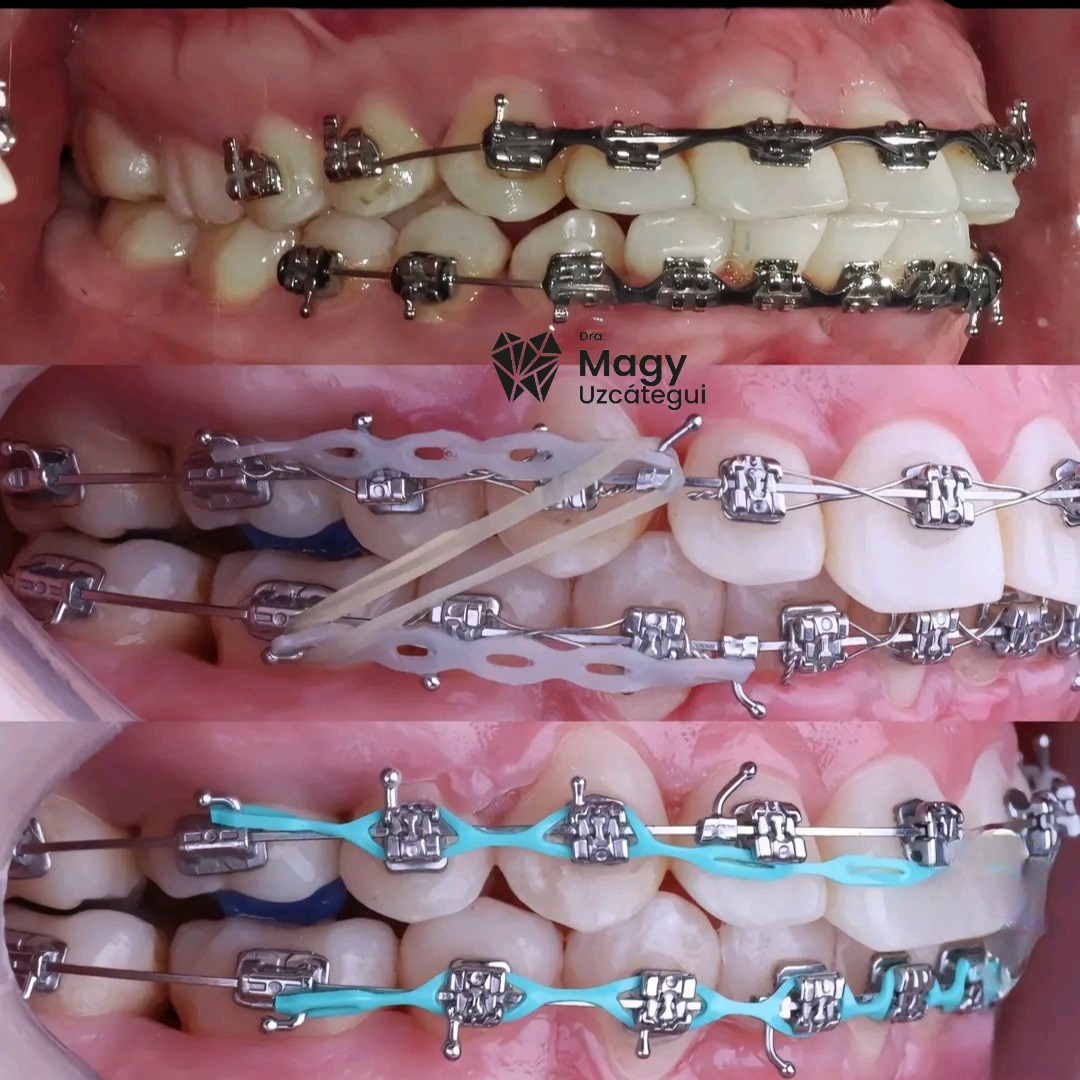 caso clinicos fotos instagram 1