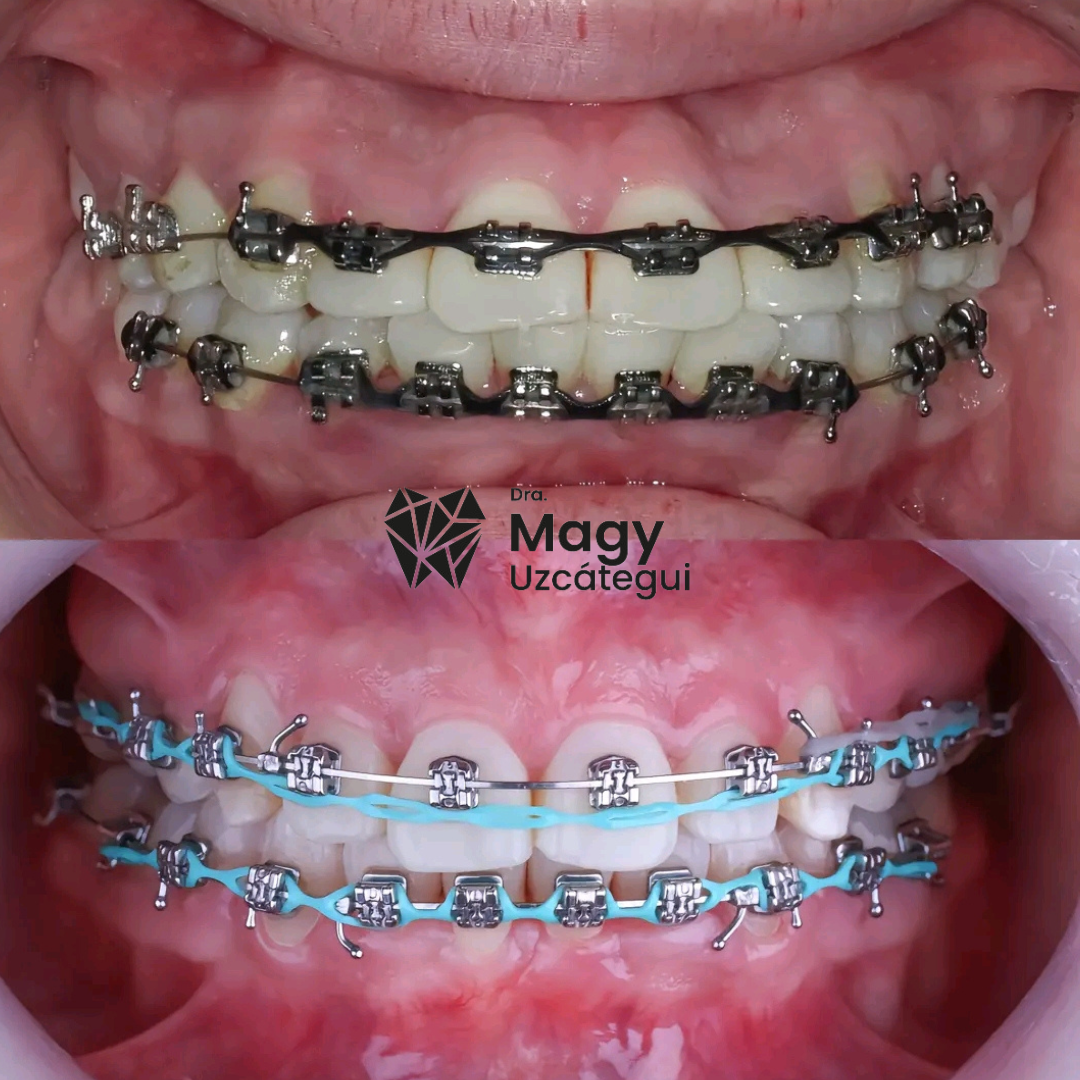 caso clinicos fotos instagram.